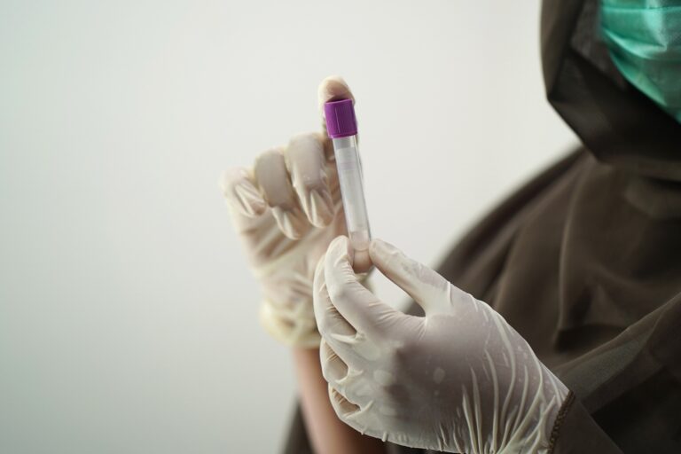 blood-test-5601437_1920